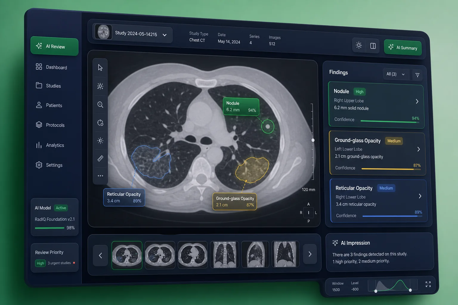 RadIQ Medical Imaging AI — core workflow screen